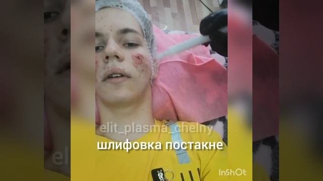 Холодная плазма