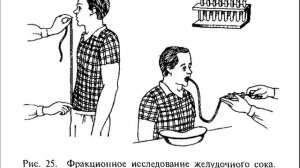 Уход-10: Уход при заболеваниях пищеварительной системы