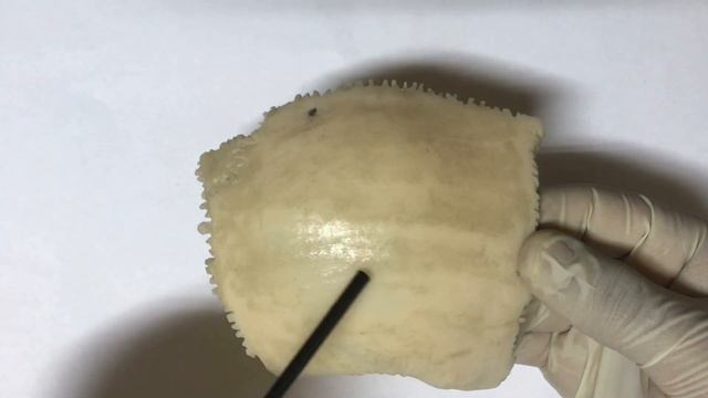 Теменная кость - Os parietale смотреть онлайн