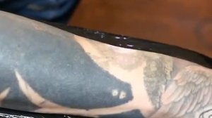 Как удалить Татуировку? лазерный метод