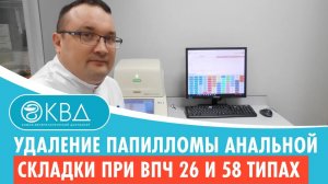 ✅ Удаление папилломы анальной складки при ВПЧ 26 и 58 типах. Клинический случай №585