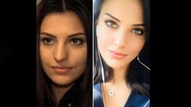 Как выглядят популярные турецкие актрисы до и после пластики