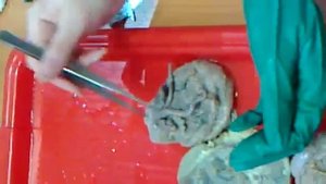 Анатомия. Мужская половая система (версия 2)