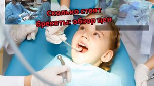 Сколько стоят брекеты: обзор цен