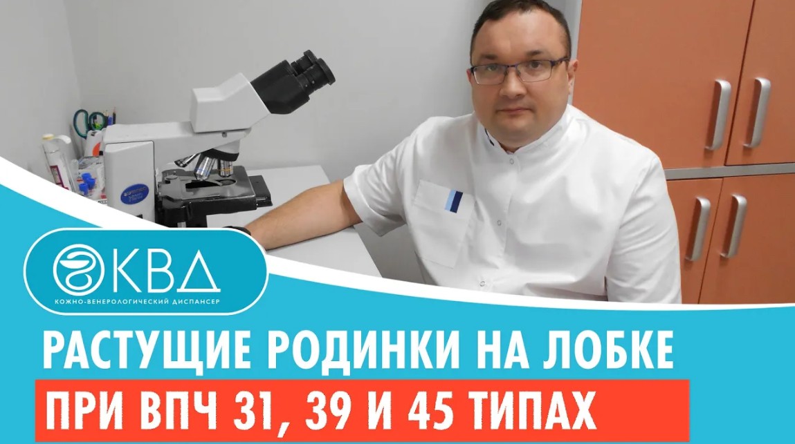 ? Растущие родинки на лобке при ВПЧ 31, 39 и 45 типах. Клинический случай №614