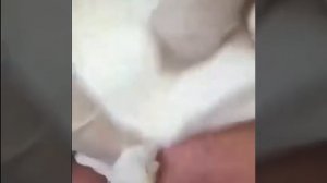 Выдавливает гнойный прыщь. Очень много гноя.