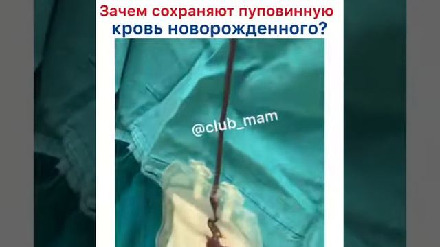 Зачем сохраняют пуповинную кровь новорожденного? смотреть онлайн