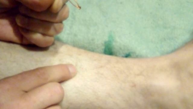 как вытащить клеща смотреть онлайн