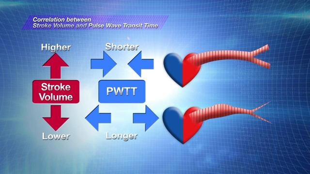 esCCO (estimated Countinuous Cardiac Output) - расчетный неинвазивный мониторинг сердечного выброса смотреть онлайн