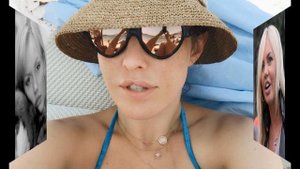 Знаменитости с заячьей губой