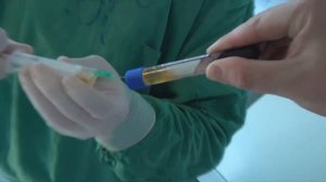 Связка надколенника