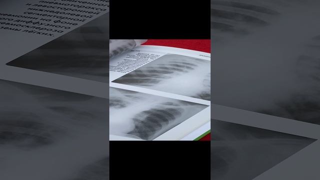 Клинико-рентгенологическая диагностика болезней органов дыхания. Общая врачебная практика