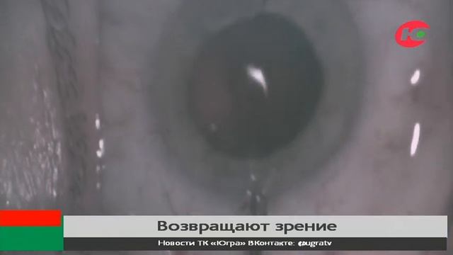 В офтальмологическом центре ОКБ Ханты-Мансийска пациенту пересадили роговицу смотреть онлайн