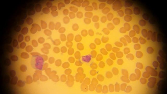 КЛЕТКИ КРОВИ под микроскопом!  BLOOD CELLS under the microscope!
