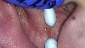 Ear Extractions on Draven