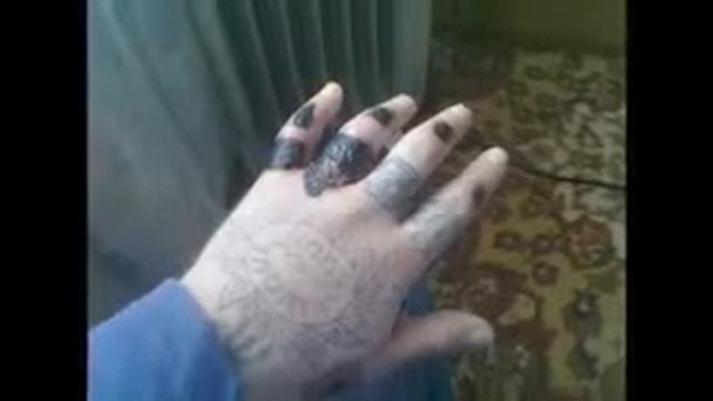 удаления татуировок,наколок смотреть онлайн