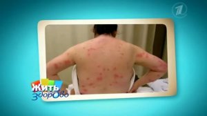 Жить здорово! Как избавиться от  клопов. Все о клопах.