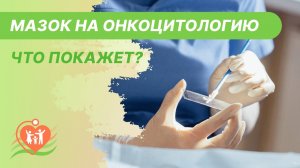 ?️ Мазок на онкоцитологию - что покажет? Онкоцитология шейки матки