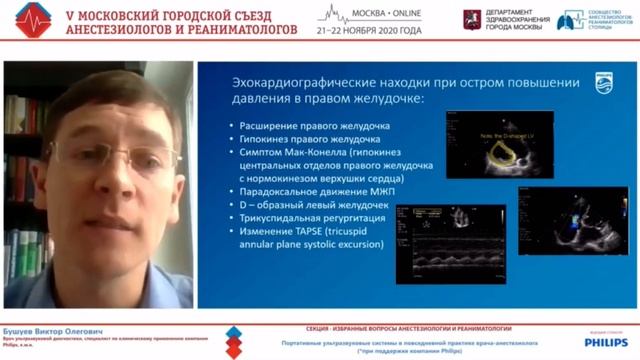 Портативные ультразвуковые системы в повседневной практике врача-анестезиолога