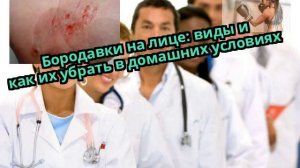 Бородавки на лице: виды и как их убрать в домашних условиях