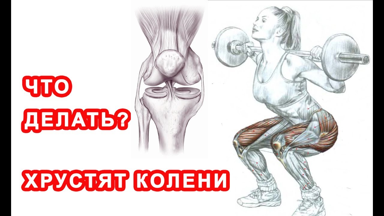 Хрустят и щЁлкают колени во время приседаний - ЧТО ДЕЛАТЬ?