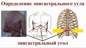Типы конституций человека