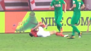 Madness - Baggy Trousers x Brexit Tackles