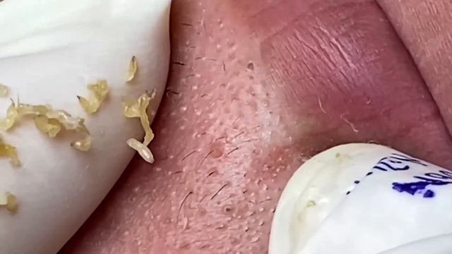 Enjoy Your Day With Hien Nguyen Spa # 1322 смотреть онлайн