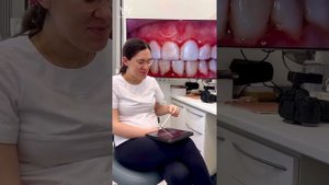 О ценах на #виниры