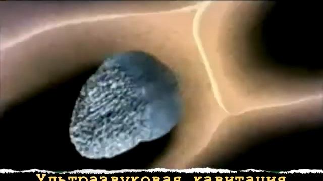 МСК: кавитация + массаж с микротоками смотреть онлайн