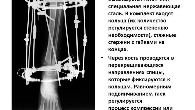 100 лет со дня рождения Г.А.Илизарова смотреть онлайн