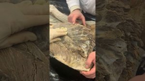 Поясничное сплетение. Иннервация нижних конечностей. Соколова Е.А.