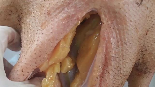 ГУСЯ ЛАПЫ ОТМОРОЗИЛА И ГУСИНЫЙ ЖИР смотреть онлайн