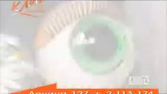 Контактные линзы смотреть онлайн