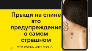 Как я избавилась от прыщей на спине | Питание | Уход за кожей