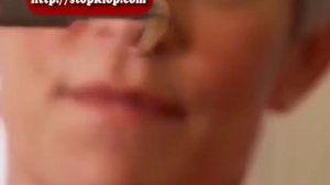 Насекомые кровососы. Опасность рядом.