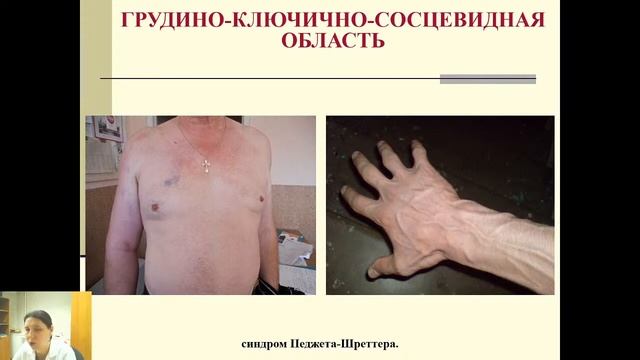 Топографическая анатомия  Шея