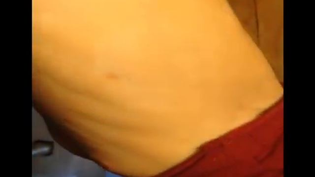 Псориаз это не болезнь Часть 1 ая Апрель 2021 смотреть онлайн