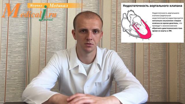 Недостаточность аортального клапана смотреть онлайн