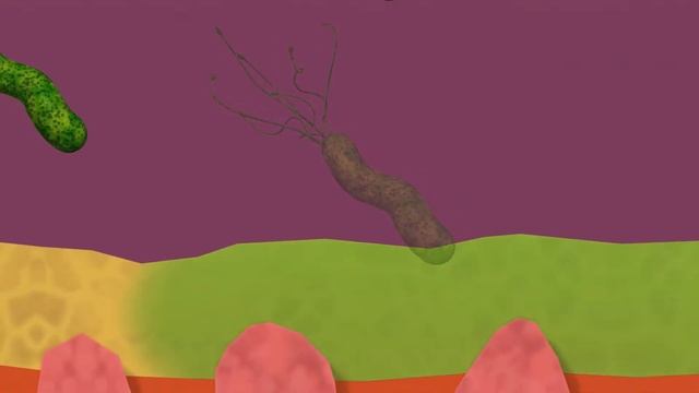 Хеликобактер пилори Helicobacter pylori язва и гастрит