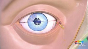 Три причины боли в глазу. Жить здорово! Фрагмент выпуска от 22.12.2017