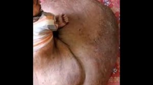 Уникальной раковой опухолью Сняли.РФ