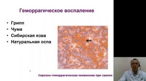 Патанатомия 3.Воспаление