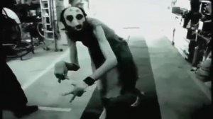 НЕ ДЛЯ СЛАБО НЕРВНЫХ!!! САМОЕ СТРАШНОЕ ВИДЕО!!!(синдром марфана)