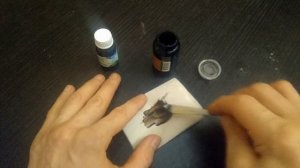 Анальный зуд, жжение, как быстро избавиться.