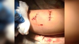 Кошки спасают людей!