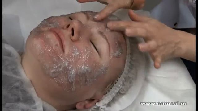 Даже небольшого количества СО2 геля достаточно, чтобы обработать даже веки смотреть онлайн