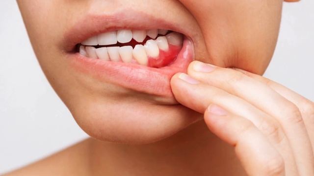 Просто начал ЖЕВАТЬ гвоздику и избавился от 10 болезней!Польза и вред гвоздики. смотреть онлайн