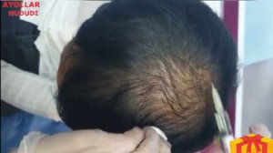 #SOCH #TOKILISHINI #UY #SHAROITIDA #DAVOLASH #СОЧ #ТОКИЛИШИНИ #УЙ #ШАРОИТИДА #ДАВОЛАШ