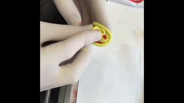 Бесплатный курс. Непрямая Фиксация Ретейнера смотреть онлайн